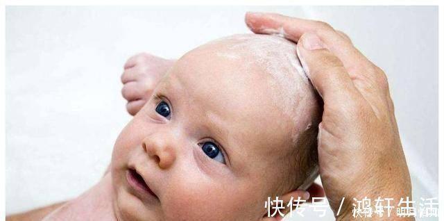 宝宝头上长了很厚的头垢怎么办