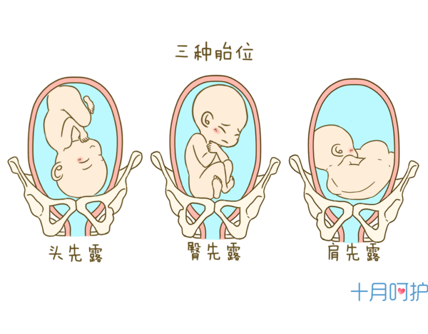 胎位不正可以手动转吗