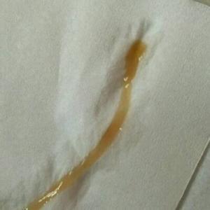 产后恶露是什么颜色