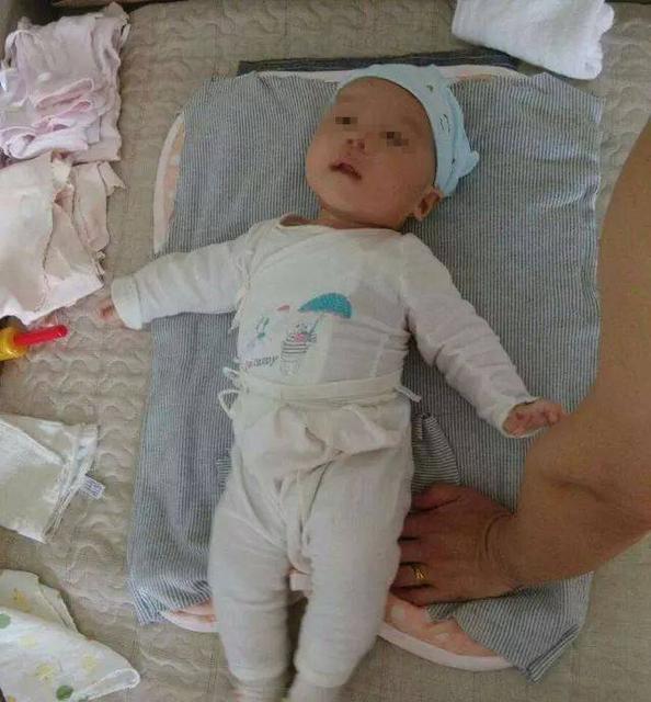 三个月宝宝肌张力高怎么办