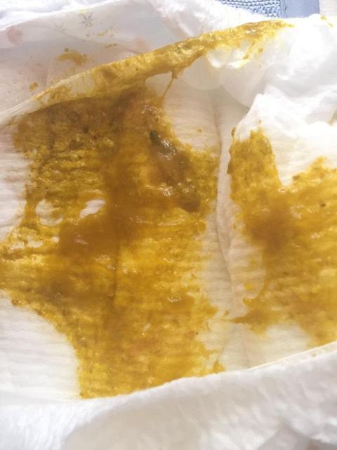 宝宝拉大便多久算一次