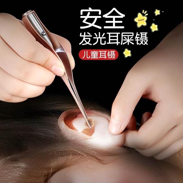 婴儿耳朵的耳屎需要清理吗