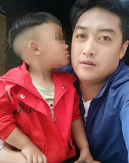 网红拉姆被前夫泼汽油，容颜尽毁成炭人，问题来了，救还是不救？