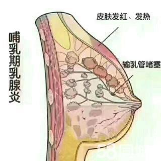 孩子经常喉咙发炎怎么推拿