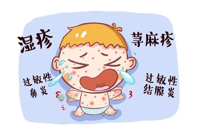 春季宝宝过敏的原因