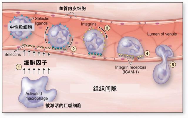 炎症因子风暴是什么意思