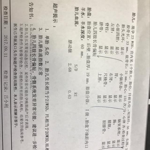 股骨长与身高的关系