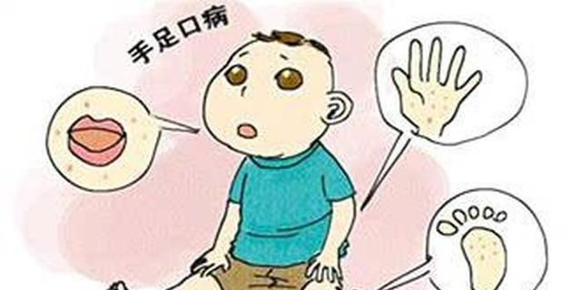 打完手足口疫苗有什么症状