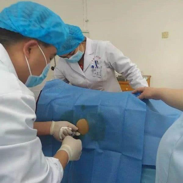 分娩球有什么用