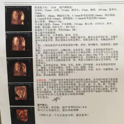 胎儿心脏有强光点要不要紧