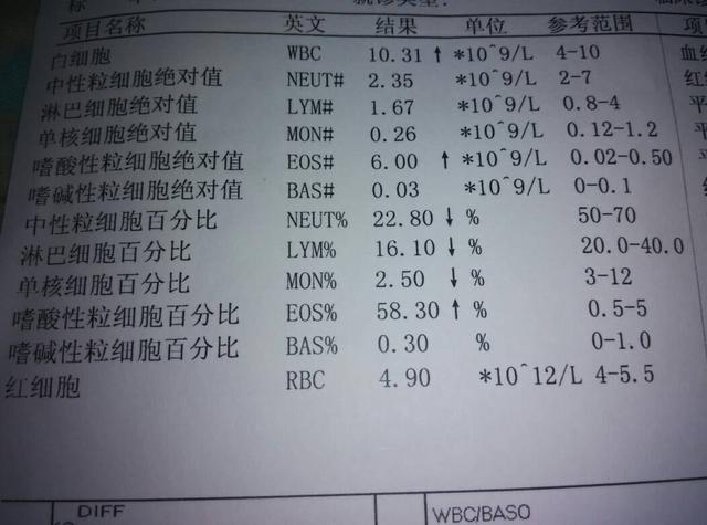 小孩血常规报告单血小板分析