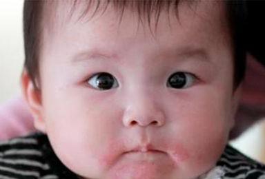 孩子为什么会缺铁和锌