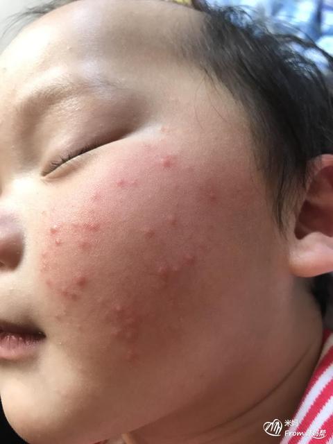 新生儿肤色是由什么决定的