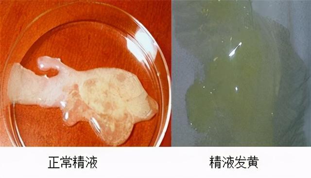 男性生殖系统健康的标准