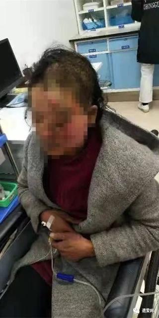 做饭时煤气罐突然爆燃