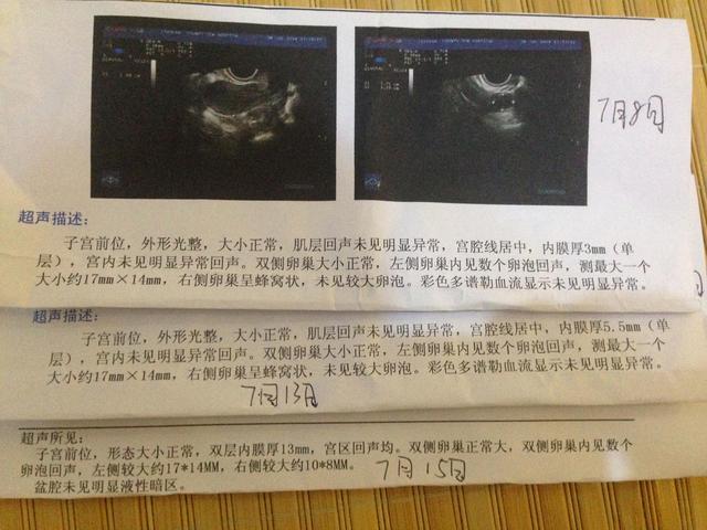 女性卵泡破裂有什么症状表现