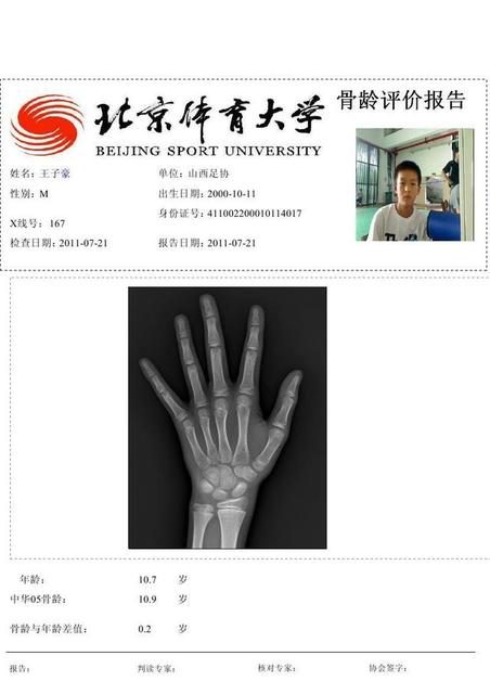 骨龄检测能看出来什么