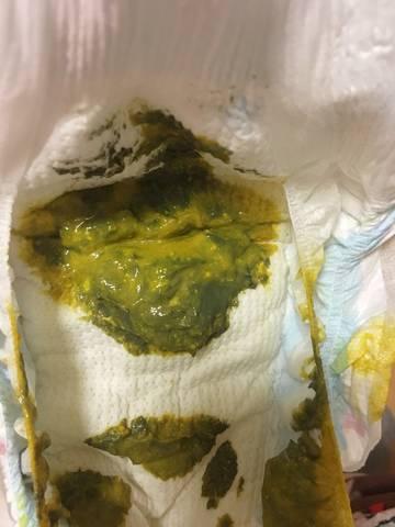 宝宝拉肚子之后吃什么好