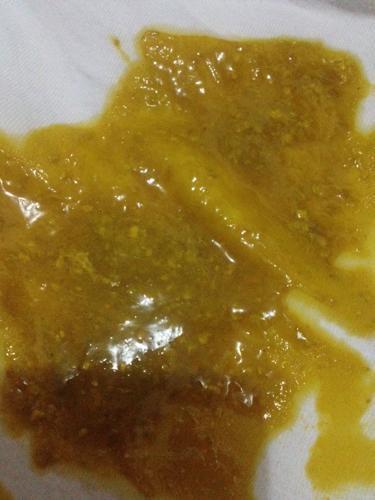 2个月宝宝的大便什么样