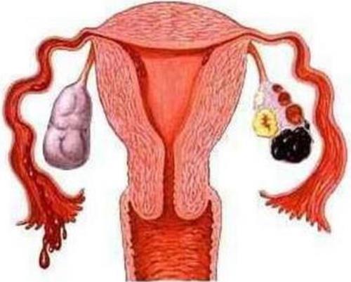 绝经后怎样保养子宫和卵巢
