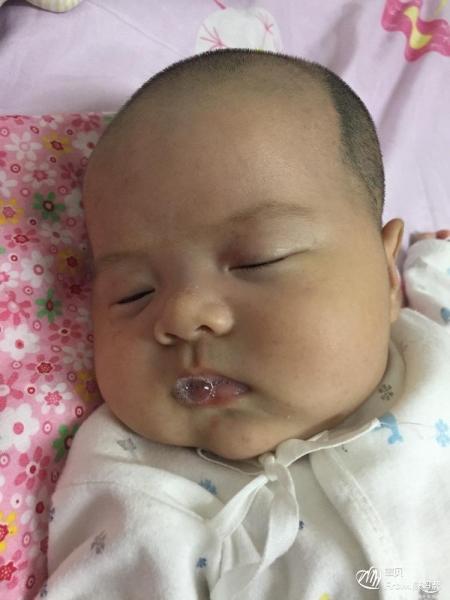 宝宝吐泡泡一定是肺炎吗?