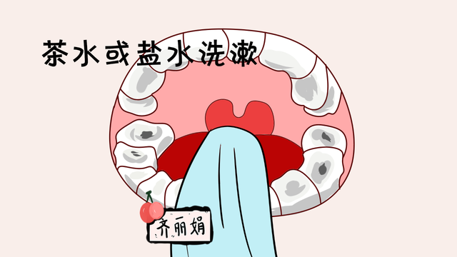 儿童口腔溃疡吃什么药好使