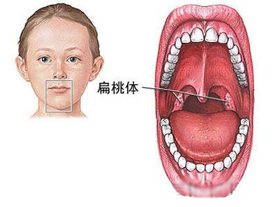 宝宝扁桃体经常发炎是什么原因