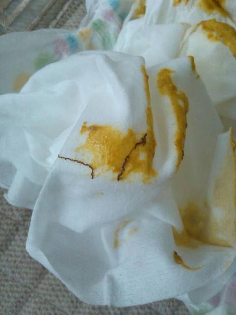 宝宝多大可以吃打虫药