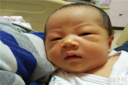 如何有效预防母乳性黄疸？6招让宝宝少受罪