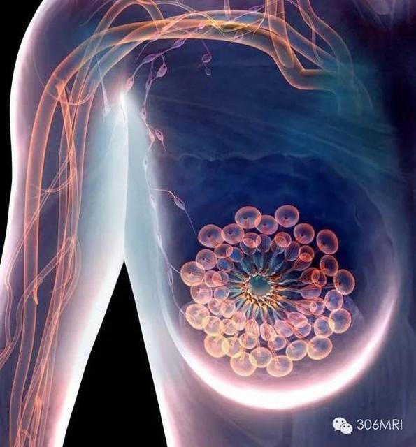 乳腺癌的高危因素有哪些,没想到它排名第一