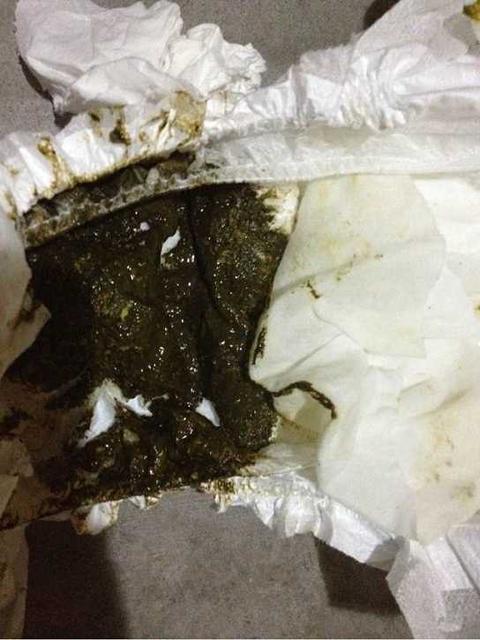 吃奶粉宝宝消化不良怎么办?
