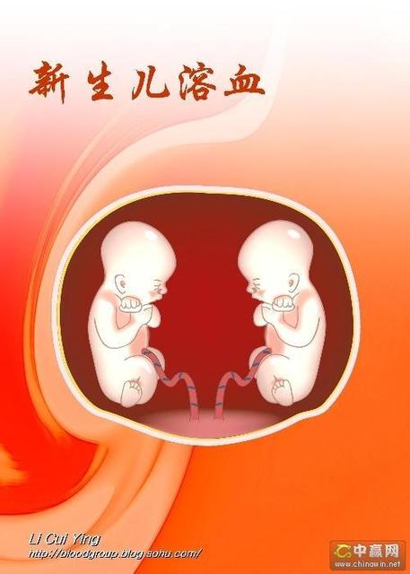 新生儿血溶症是什么原因