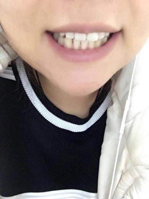 给宝宝一口好牙齿