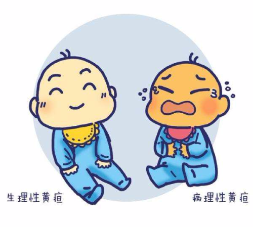 宝宝黄疸值下去了又上升了