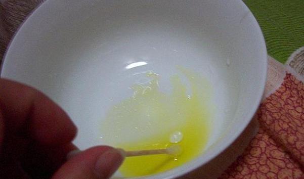 婴儿的乳痂可以用手剥吗