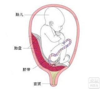 胎盘前置和胎盘低置有什么区别
