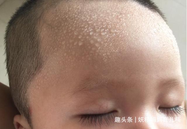 小宝宝特别容易出汗是什么原因