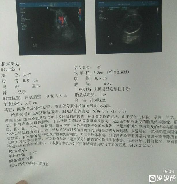 孕期B超检查