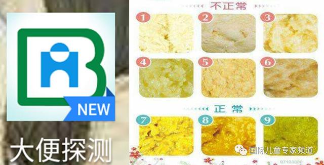 3岁孩子大便拉裤子里正常吗
