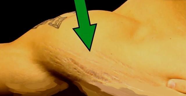 孩子大腿痛是生长痛吗