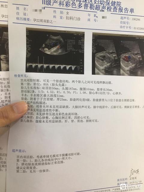 双胞胎如何形成