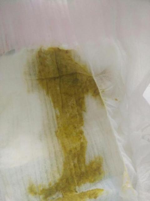 宝宝吃母乳拉稀怎么回事