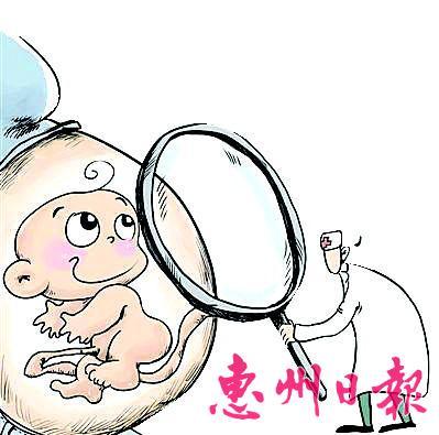 高龄孕妇需要做些什么准备