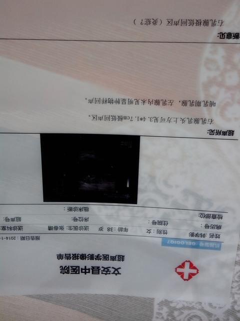 孩子发烧需要检查血常规吗