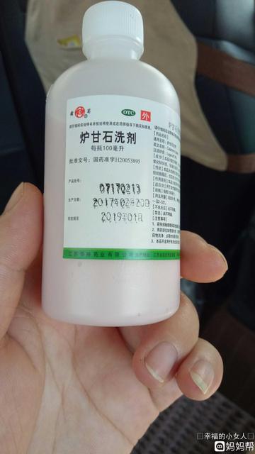 婴儿起痱子能用炉甘石吗