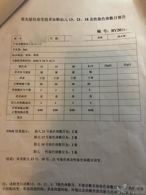 怀孕24周该做什么检查了