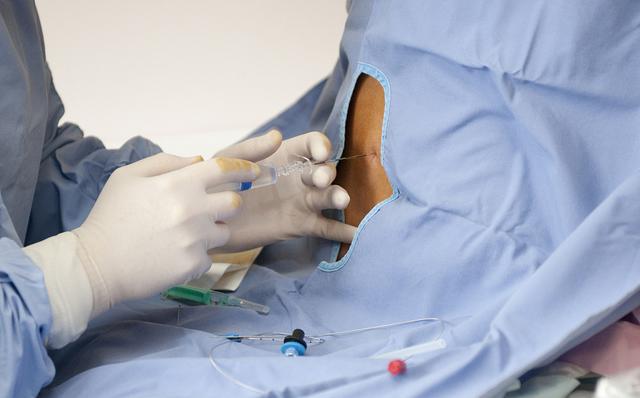 分娩的无痛方法有哪些