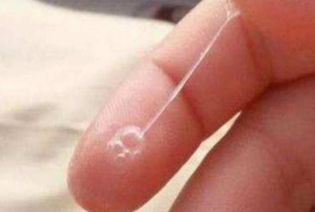 宝宝容易尿路感染