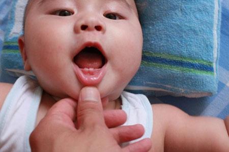 孩子出牙晚好吗