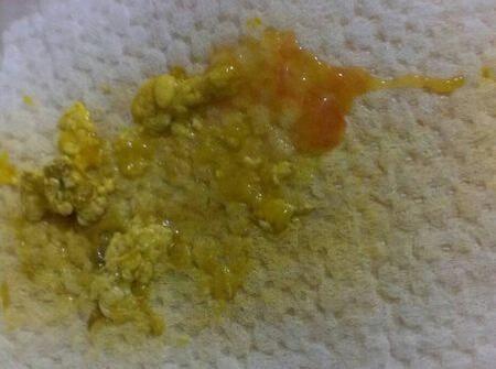 如何进行混合喂养孩子